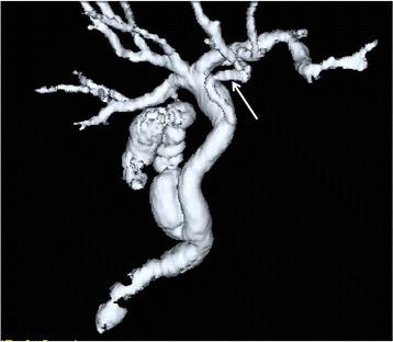 https://cdn.ncbi.nlm.nih.gov/pmc/blobs/ac9d/5422935/94177b767918/12893_2017_251_Fig6_HTML.jpg