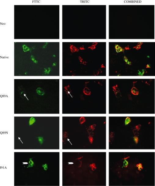 https://cdn.ncbi.nlm.nih.gov/pmc/blobs/ac9f/1859983/84823bcfac4a/cmi0009-0329-f8.jpg