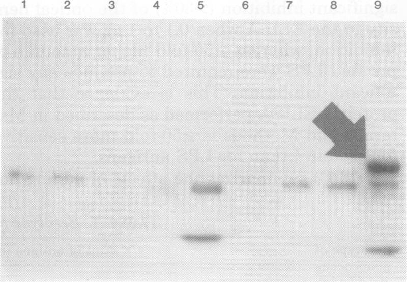 https://cdn.ncbi.nlm.nih.gov/pmc/blobs/ac9f/351548/143b5a84dabb/iai00164-0026-a.jpg