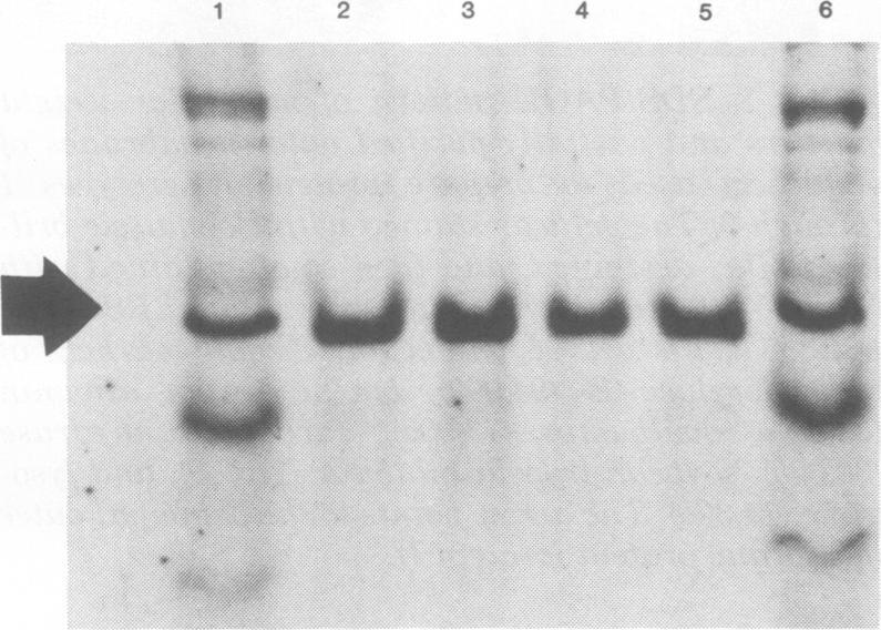 https://cdn.ncbi.nlm.nih.gov/pmc/blobs/ac9f/351548/6825becd3d8a/iai00164-0024-a.jpg