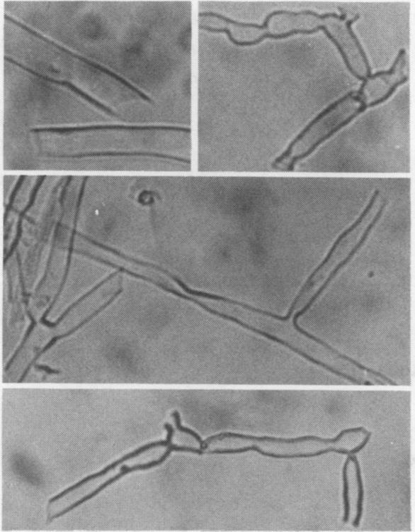 https://cdn.ncbi.nlm.nih.gov/pmc/blobs/aca1/425823/c77374018797/plntphys00535-0165-a.jpg