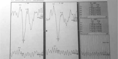 https://cdn.ncbi.nlm.nih.gov/pmc/blobs/aca4/5076309/b4848f20110e/TJO-46-41-g3.jpg