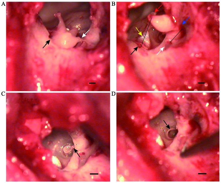 https://cdn.ncbi.nlm.nih.gov/pmc/blobs/aca5/6327628/877d1816396b/etm-17-02-1248-g03.jpg