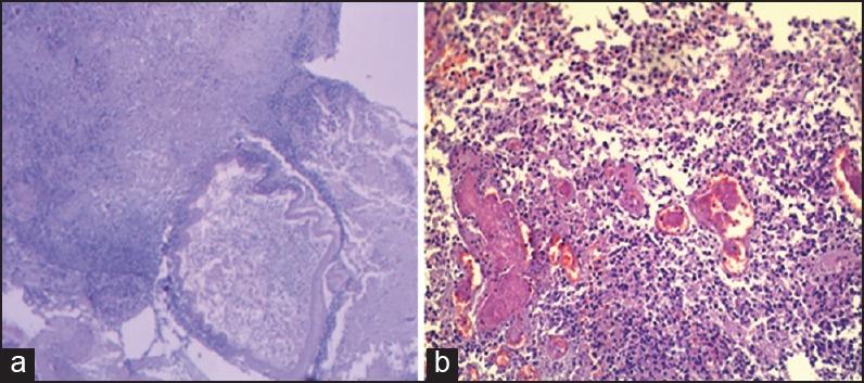 https://cdn.ncbi.nlm.nih.gov/pmc/blobs/aca9/4693305/7956ba98e1b6/JGID-7-143-g003.jpg