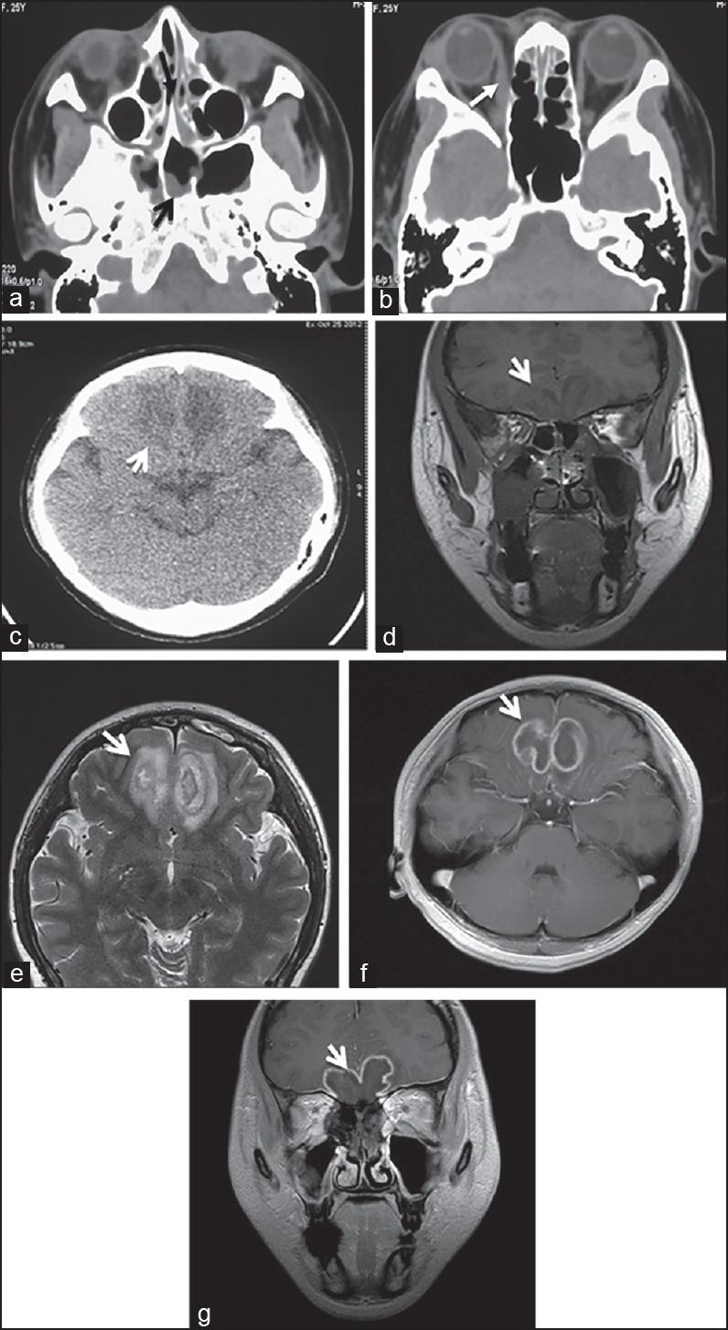 https://cdn.ncbi.nlm.nih.gov/pmc/blobs/aca9/4693305/8cf4cf766eb5/JGID-7-143-g002.jpg
