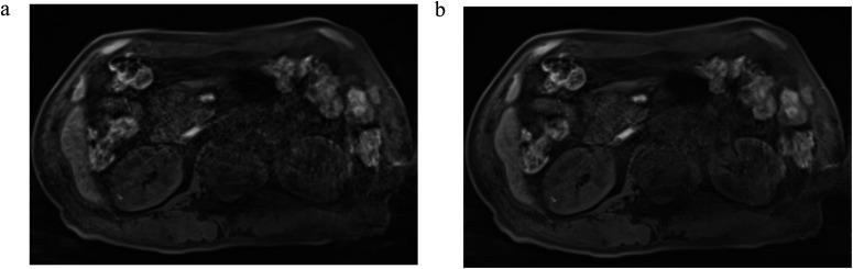 https://cdn.ncbi.nlm.nih.gov/pmc/blobs/acb0/10552666/51b140eb288e/mrms-22-477-g3.jpg