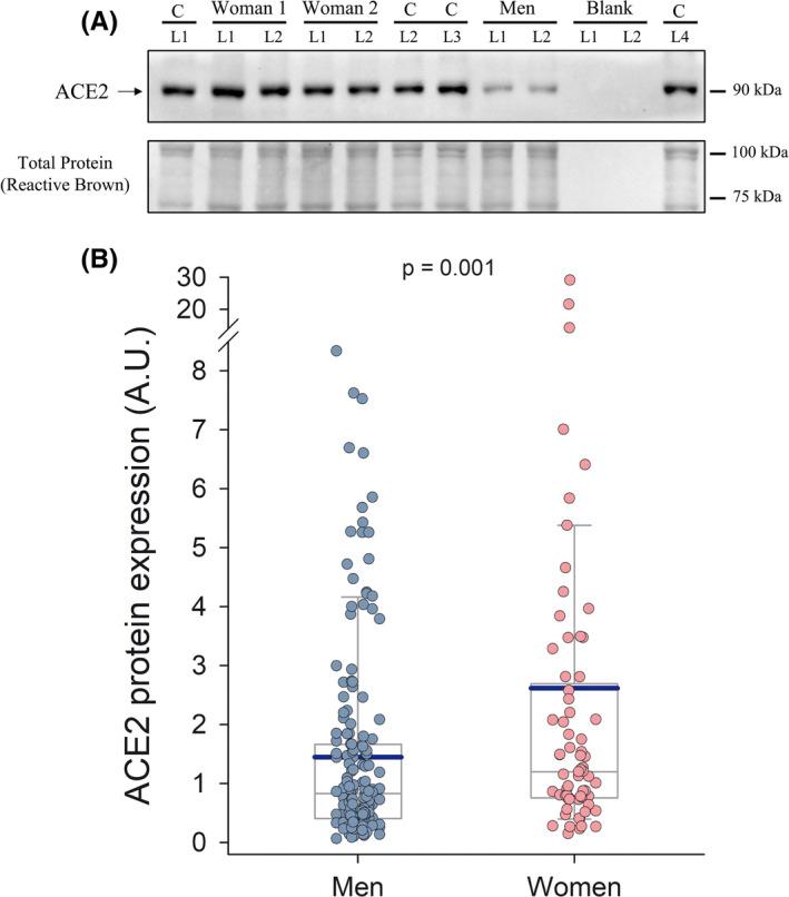 https://cdn.ncbi.nlm.nih.gov/pmc/blobs/acb2/8662278/b26ce5769835/SMS-31-2249-g003.jpg