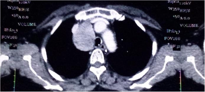 https://cdn.ncbi.nlm.nih.gov/pmc/blobs/acb8/7776121/8a5c7487083a/gr1.jpg