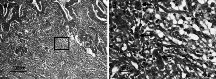 https://cdn.ncbi.nlm.nih.gov/pmc/blobs/acc4/4653248/8cb513c0a799/10147_2015_801_Fig15_HTML.jpg