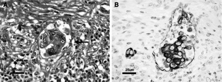 https://cdn.ncbi.nlm.nih.gov/pmc/blobs/acc4/4653248/e137ba2996ba/10147_2015_801_Fig13_HTML.jpg