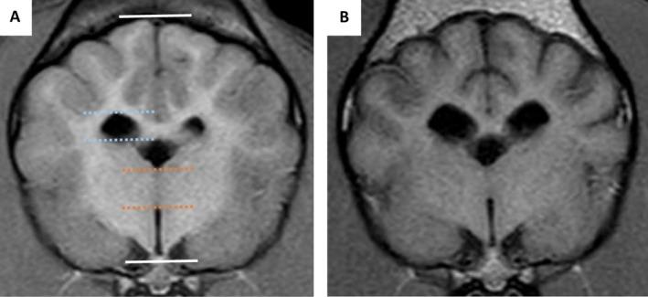 https://cdn.ncbi.nlm.nih.gov/pmc/blobs/acc5/12143025/30140893e40c/JVIM-39-e70095-g001.jpg
