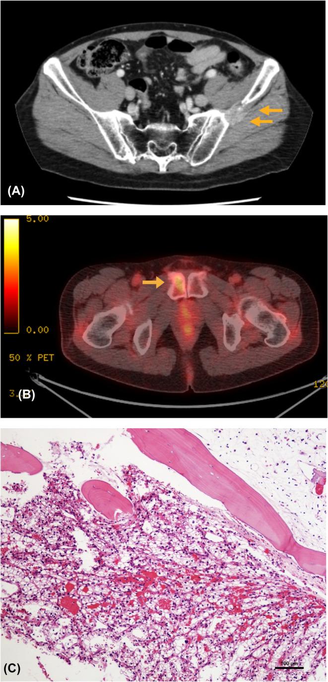 https://cdn.ncbi.nlm.nih.gov/pmc/blobs/acc8/10907337/ef575d1b5ffa/CCR3-12-e8482-g001.jpg