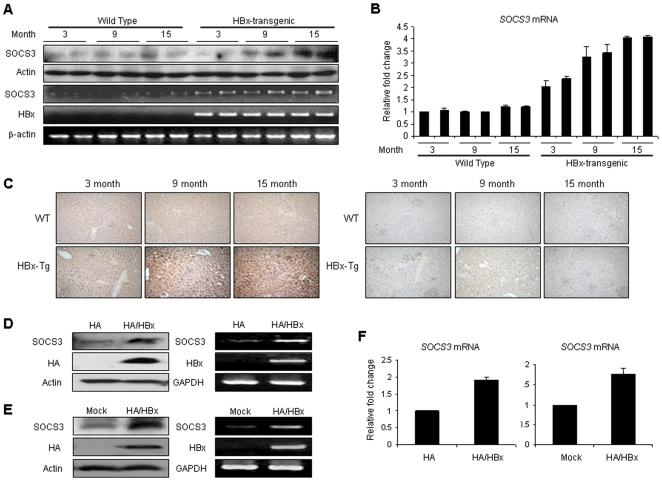 https://cdn.ncbi.nlm.nih.gov/pmc/blobs/acc8/2843628/535d75a2a188/pone.0008649.g002.jpg