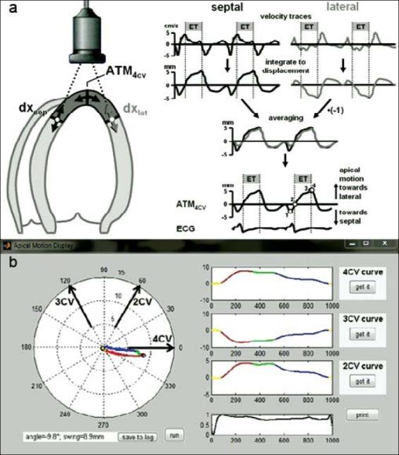 https://cdn.ncbi.nlm.nih.gov/pmc/blobs/acd5/5336861/cde23d95b223/AJC-15-620-g002.jpg