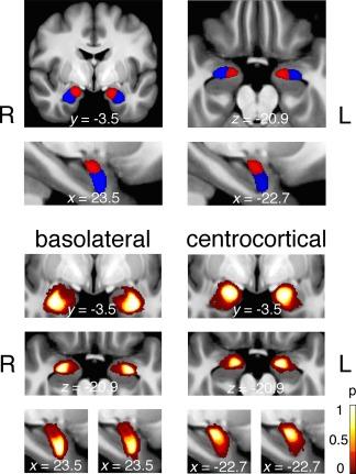 https://cdn.ncbi.nlm.nih.gov/pmc/blobs/acda/6867034/cad2141b54df/HBM-38-3927-g001.jpg