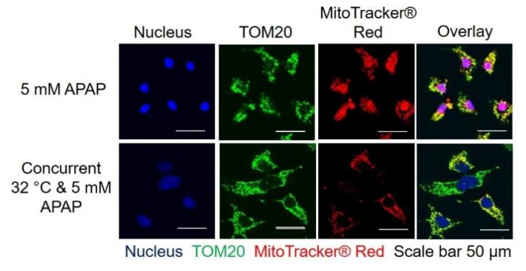 https://cdn.ncbi.nlm.nih.gov/pmc/blobs/acdd/7693152/0c9f8ff6aad5/cells-09-02354-g003.jpg