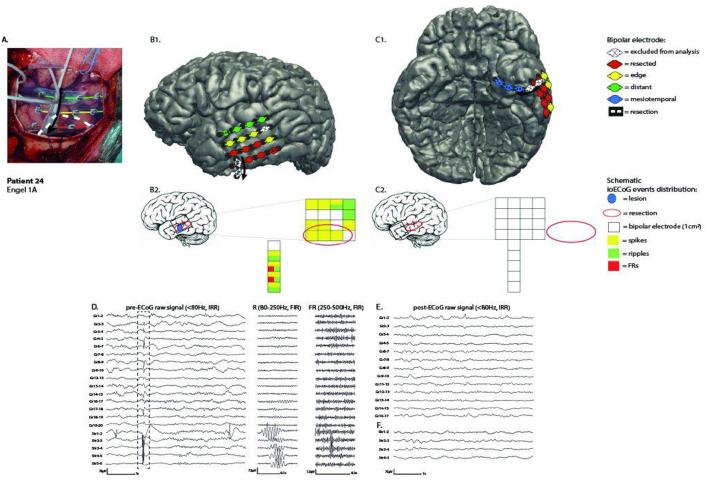 https://cdn.ncbi.nlm.nih.gov/pmc/blobs/ace4/9379925/b8b6694548e6/fneur-13-797075-g0001.jpg