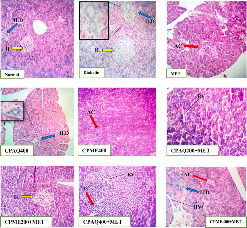 https://cdn.ncbi.nlm.nih.gov/pmc/blobs/ace5/9039101/e38cd77d1416/gr5.jpg