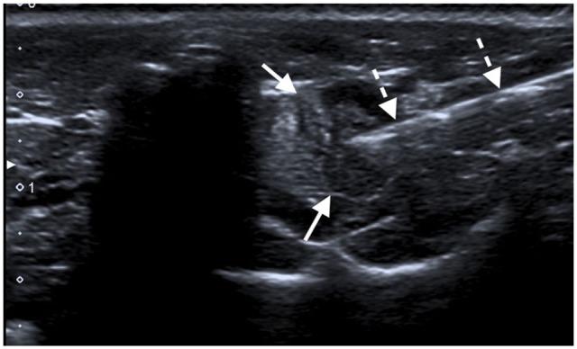 https://cdn.ncbi.nlm.nih.gov/pmc/blobs/acf0/6607573/0e70b2e217e6/10.1177_2055116919860276-fig5.jpg