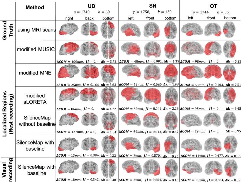 https://cdn.ncbi.nlm.nih.gov/pmc/blobs/acf3/8010113/9f20be6a5884/42003_2021_1768_Fig3_HTML.jpg