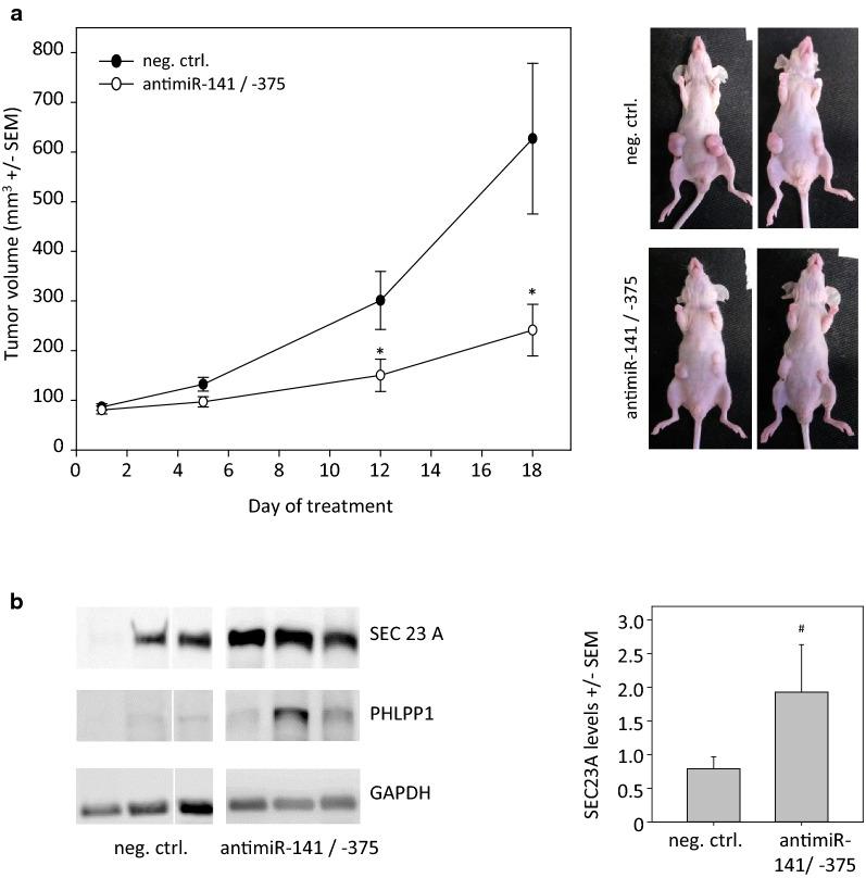 https://cdn.ncbi.nlm.nih.gov/pmc/blobs/acf6/7685669/0676830811bd/12951_2020_728_Fig3_HTML.jpg