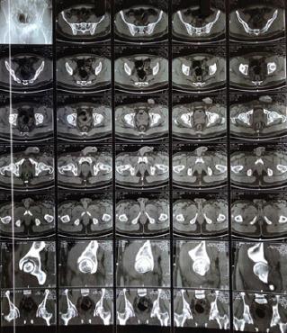 https://cdn.ncbi.nlm.nih.gov/pmc/blobs/acf7/9826670/8412a0ed5004/JOCR-12-66-g005.jpg