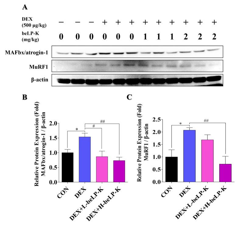 https://cdn.ncbi.nlm.nih.gov/pmc/blobs/acfb/12348042/02e5a361301e/ijms-26-07504-g010.jpg