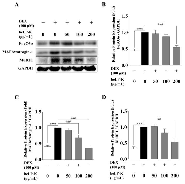 https://cdn.ncbi.nlm.nih.gov/pmc/blobs/acfb/12348042/414a487632fa/ijms-26-07504-g005.jpg