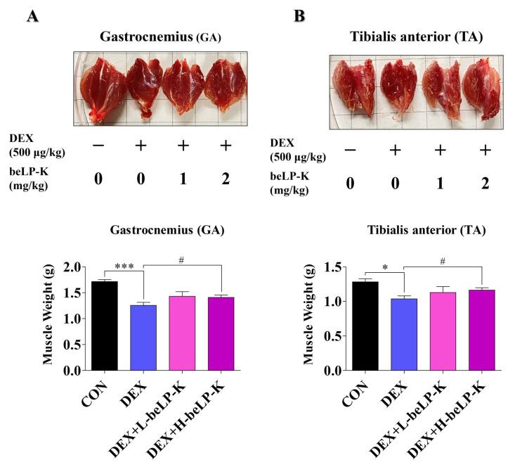 https://cdn.ncbi.nlm.nih.gov/pmc/blobs/acfb/12348042/77914c26e9cd/ijms-26-07504-g009.jpg