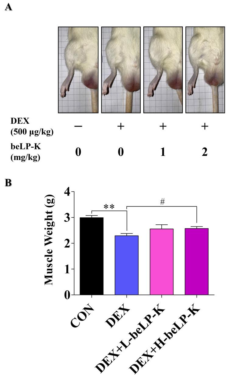 https://cdn.ncbi.nlm.nih.gov/pmc/blobs/acfb/12348042/828a973de295/ijms-26-07504-g008.jpg