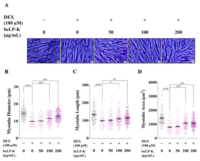 https://cdn.ncbi.nlm.nih.gov/pmc/blobs/acfb/12348042/c5ec24e0231b/ijms-26-07504-g004.jpg