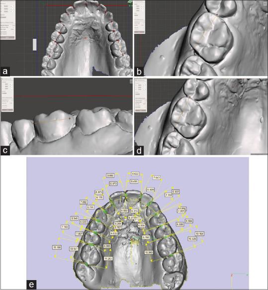https://cdn.ncbi.nlm.nih.gov/pmc/blobs/acfd/7583543/321080390c56/CCD-11-141-g002.jpg