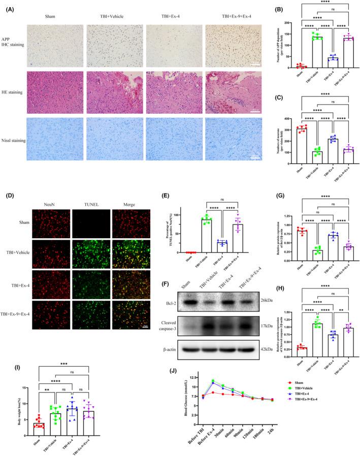 https://cdn.ncbi.nlm.nih.gov/pmc/blobs/ad08/10651945/bf5c4fb14c4d/CNS-29-3876-g002.jpg