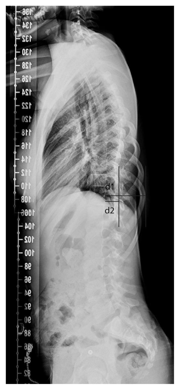 https://cdn.ncbi.nlm.nih.gov/pmc/blobs/ad0f/9260411/ea509bfaaeab/asj-2020-0398f3.jpg