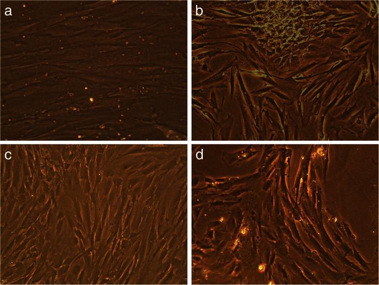https://cdn.ncbi.nlm.nih.gov/pmc/blobs/ad12/4823340/33faf4402570/210_2016_1219_Fig6_HTML.jpg