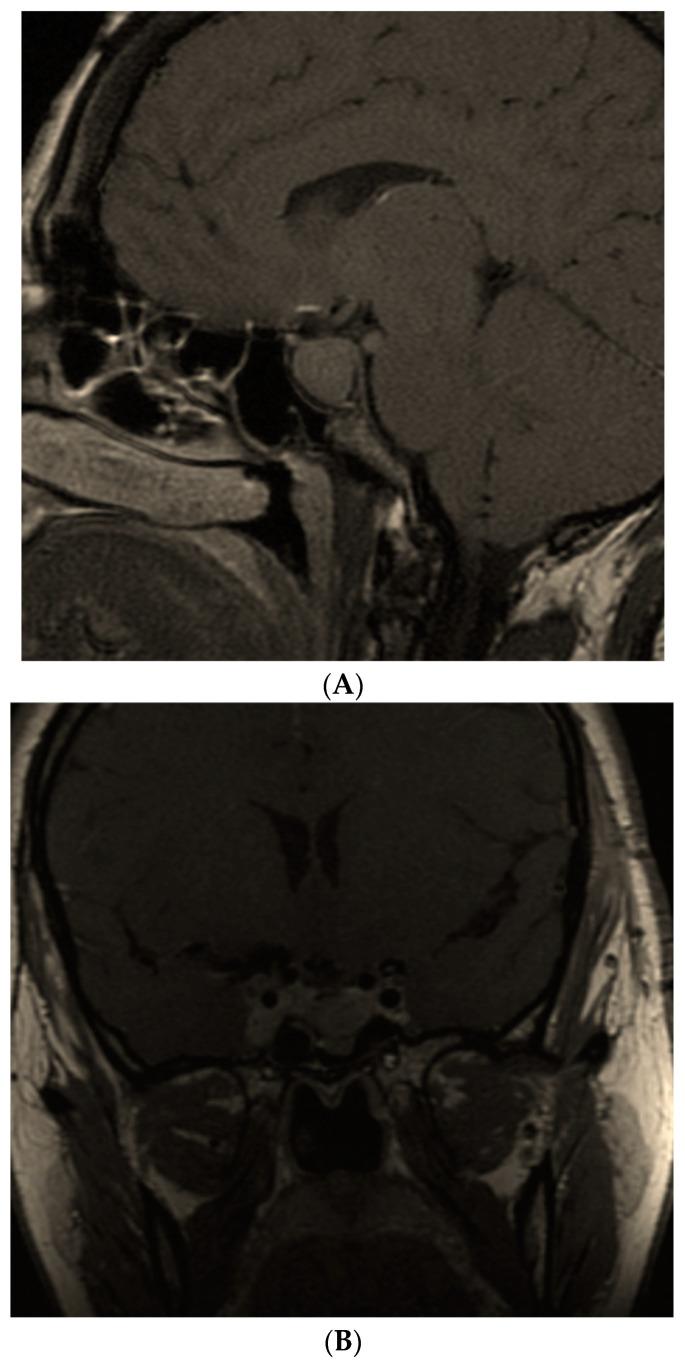 https://cdn.ncbi.nlm.nih.gov/pmc/blobs/ad1d/9689290/b7782121abc5/diagnostics-12-02669-g004a.jpg