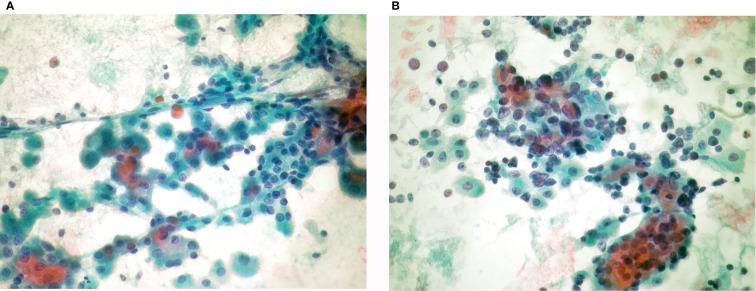 https://cdn.ncbi.nlm.nih.gov/pmc/blobs/ad1e/8267832/9f704f9c3725/fendo-12-701877-g002.jpg