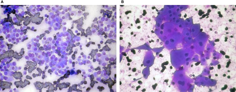 https://cdn.ncbi.nlm.nih.gov/pmc/blobs/ad1e/8267832/e748c953f0b2/fendo-12-701877-g001.jpg