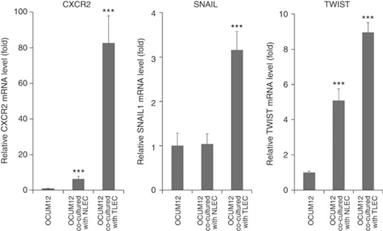 https://cdn.ncbi.nlm.nih.gov/pmc/blobs/ad21/4651131/699236129d1c/bjc2015282f6.jpg