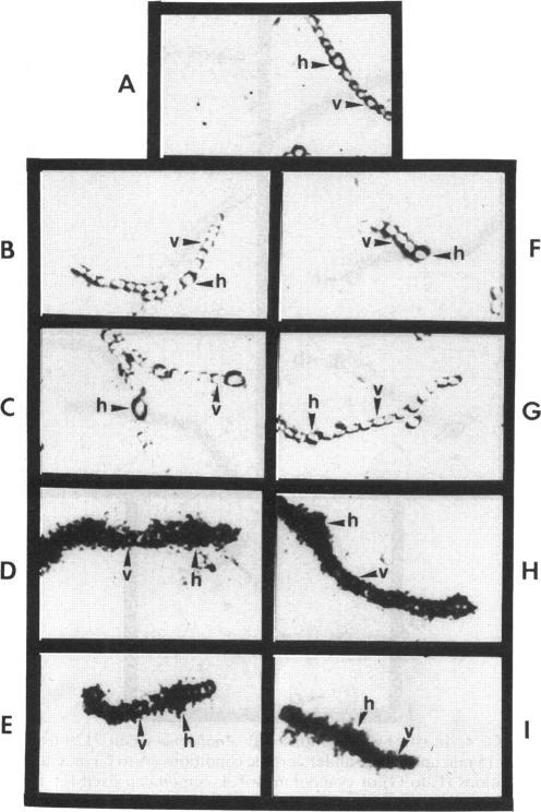 https://cdn.ncbi.nlm.nih.gov/pmc/blobs/ad24/206873/6e9059181ee9/jbacter00064-0189-a.jpg