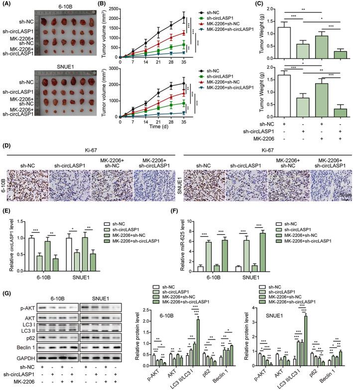 https://cdn.ncbi.nlm.nih.gov/pmc/blobs/ad2b/10154807/9bdbeab6590c/CAS-114-2123-g012.jpg