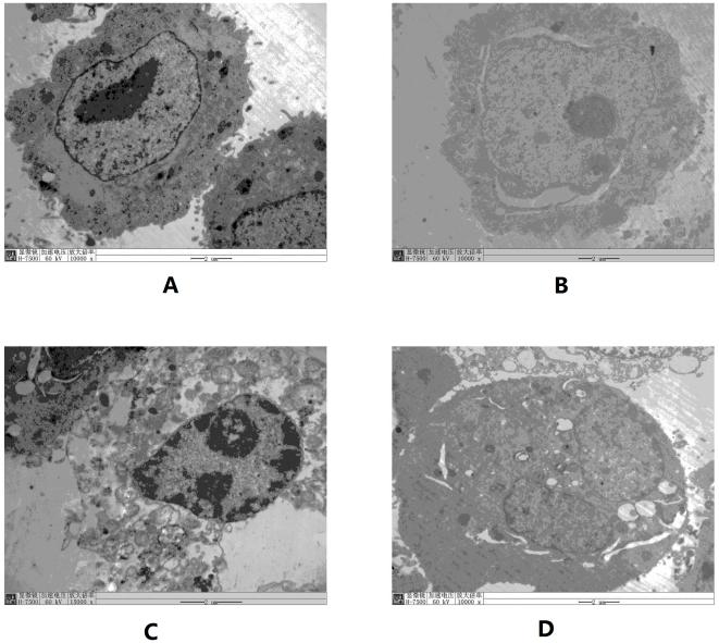 https://cdn.ncbi.nlm.nih.gov/pmc/blobs/ad2d/3247211/6e727898762f/pone.0027113.g003.jpg