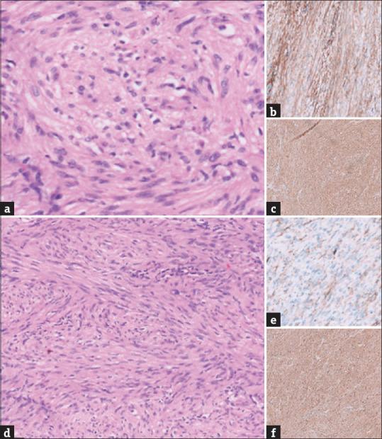 https://cdn.ncbi.nlm.nih.gov/pmc/blobs/ad30/11521212/04aaaccc108f/JIAPS-29-566-g002.jpg