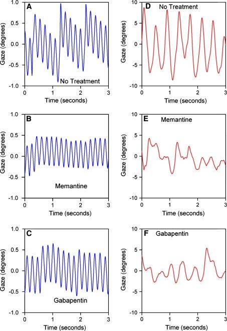 https://cdn.ncbi.nlm.nih.gov/pmc/blobs/ad32/3132281/a307e510128f/415_2011_5999_Fig4_HTML.jpg