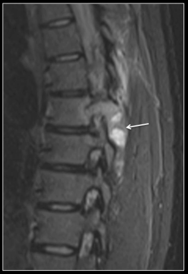 https://cdn.ncbi.nlm.nih.gov/pmc/blobs/ad32/7746321/faa7de1d51e4/cureus-0012-00000011526-i01.jpg