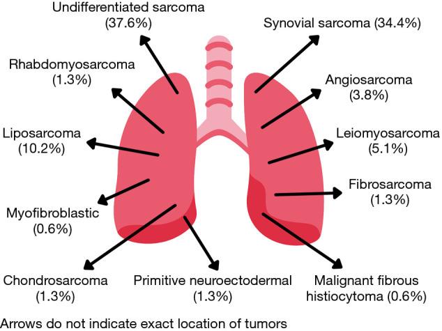 https://cdn.ncbi.nlm.nih.gov/pmc/blobs/ad34/9562530/425aea46fc44/jtd-14-09-3376-f1.jpg