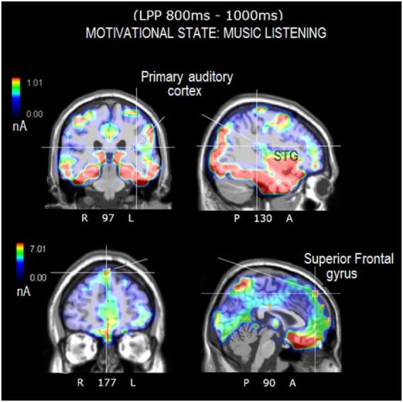 https://cdn.ncbi.nlm.nih.gov/pmc/blobs/ad39/10050745/9082884ca920/fnhum-17-1146789-g008.jpg