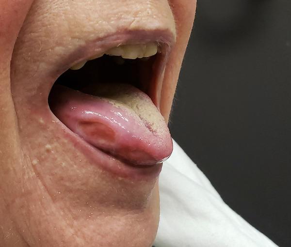 https://cdn.ncbi.nlm.nih.gov/pmc/blobs/ad40/9578098/1d0d8107631f/amjcaserep-23-e937565-g001.jpg