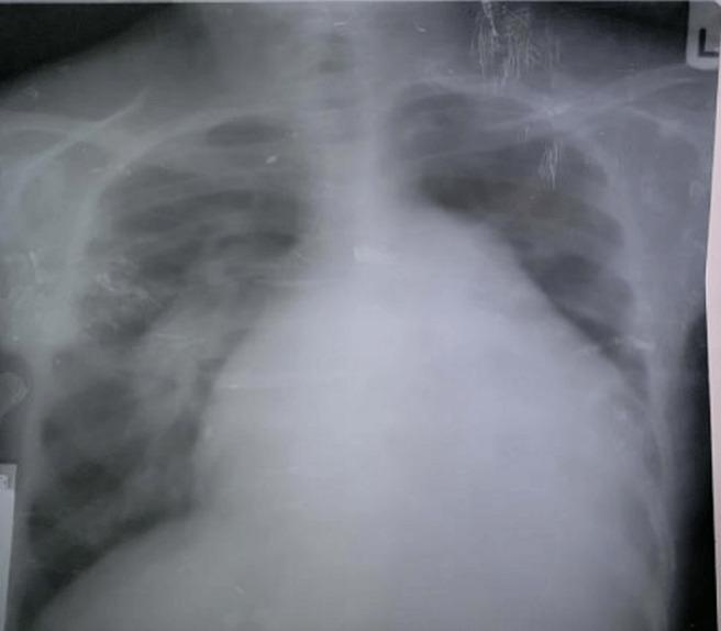 https://cdn.ncbi.nlm.nih.gov/pmc/blobs/ad47/9279463/ed48aac19c10/PAMJ-41-342-g001.jpg