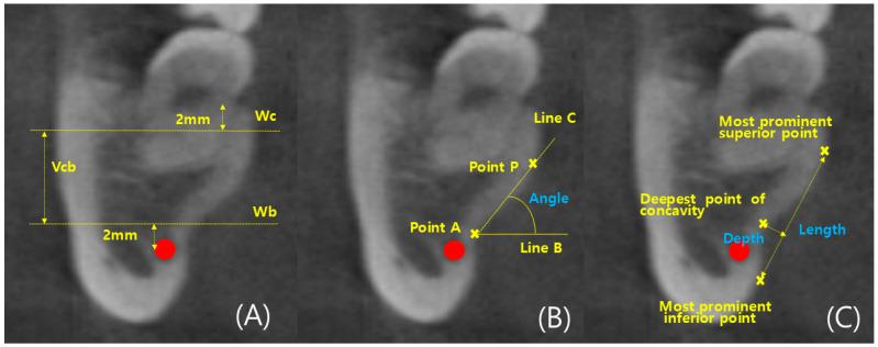 https://cdn.ncbi.nlm.nih.gov/pmc/blobs/ad4e/11353795/5b36276fabe7/diagnostics-14-01792-g003.jpg
